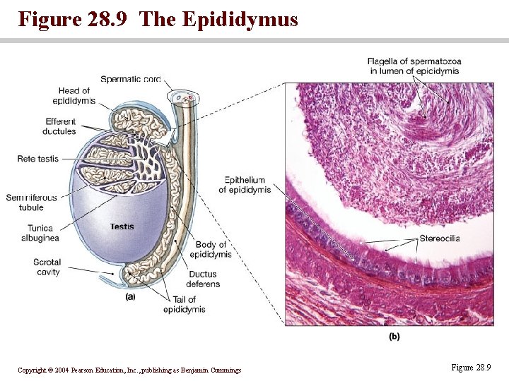 Figure 28. 9 The Epididymus Copyright © 2004 Pearson Education, Inc. , publishing as Figure 28. 9 The Epididymus Copyright © 2004 Pearson Education, Inc. , publishing as