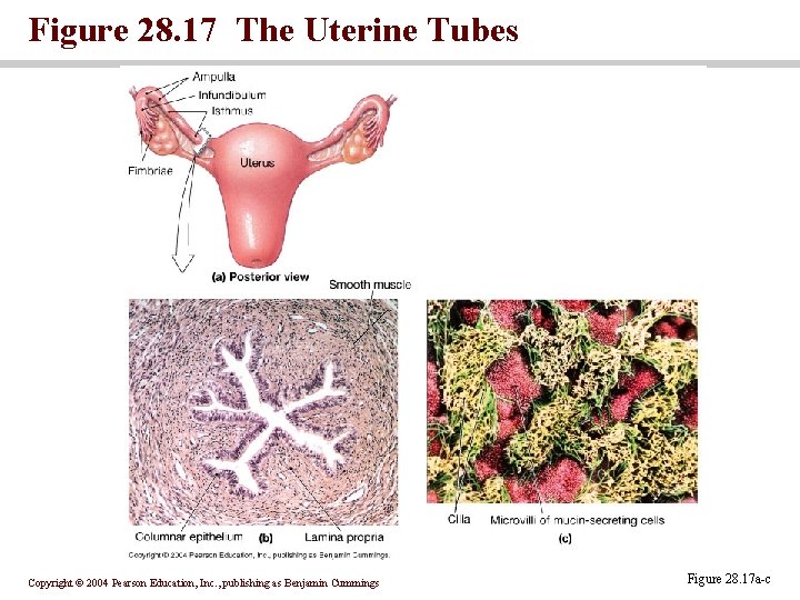 Figure 28. 17 The Uterine Tubes Copyright © 2004 Pearson Education, Inc. , publishing
