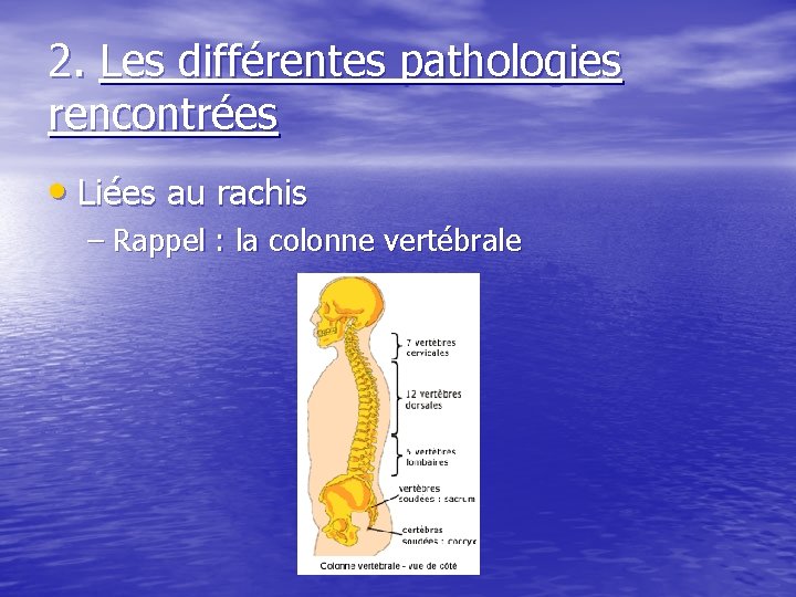 2. Les différentes pathologies rencontrées • Liées au rachis – Rappel : la colonne
