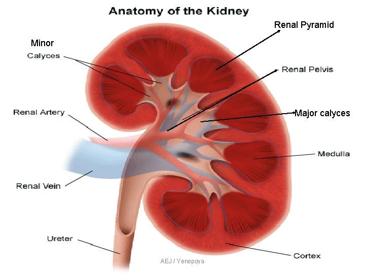 Renal Pyramid Minor Major calyces AEJ / Yenepoya Renal Pyramid Minor Major calyces AEJ / Yenepoya