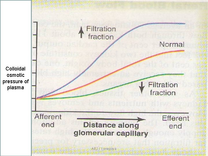 Colloidal osmotic pressure of plasma AEJ / Yenepoya Colloidal osmotic pressure of plasma AEJ / Yenepoya