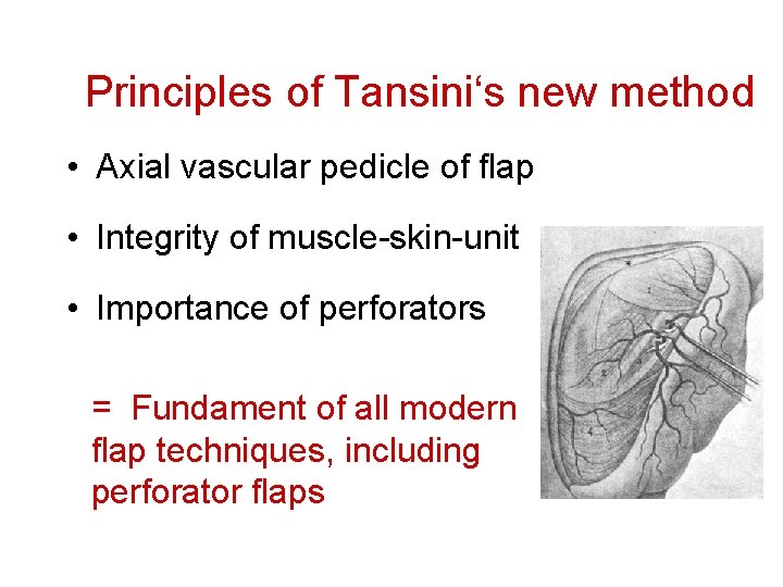 Principles of Tansini‘s new method • Axial vascular pedicle of flap • Integrity of