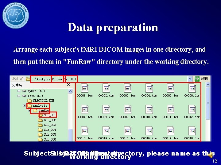 Data preparation Arrange each subject's f. MRI DICOM images in one directory, and then