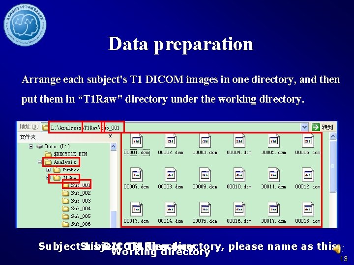 Data preparation Arrange each subject's T 1 DICOM images in one directory, and then