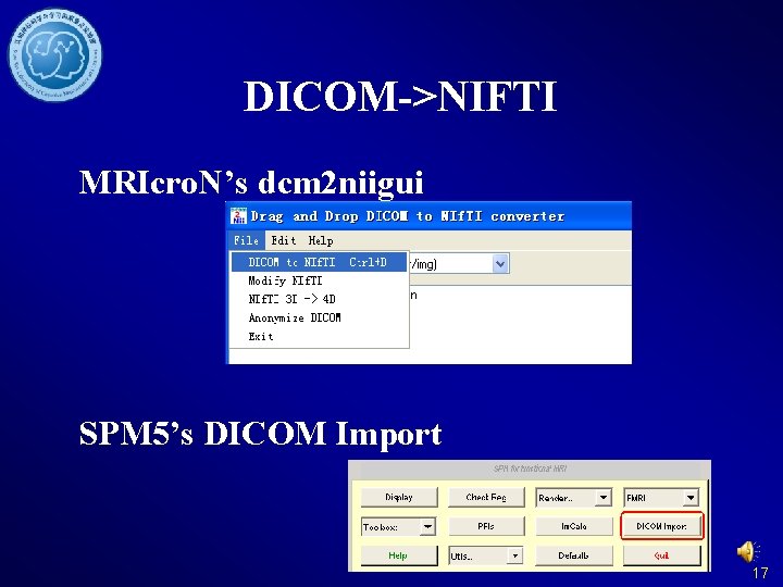 DICOM->NIFTI MRIcro. N’s dcm 2 niigui SPM 5’s DICOM Import 17 