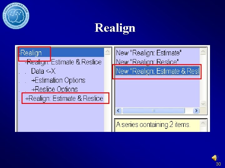 Realign 30 