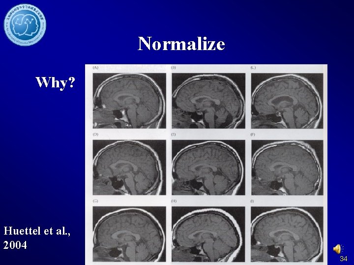 Normalize Why? Huettel et al. , 2004 34 