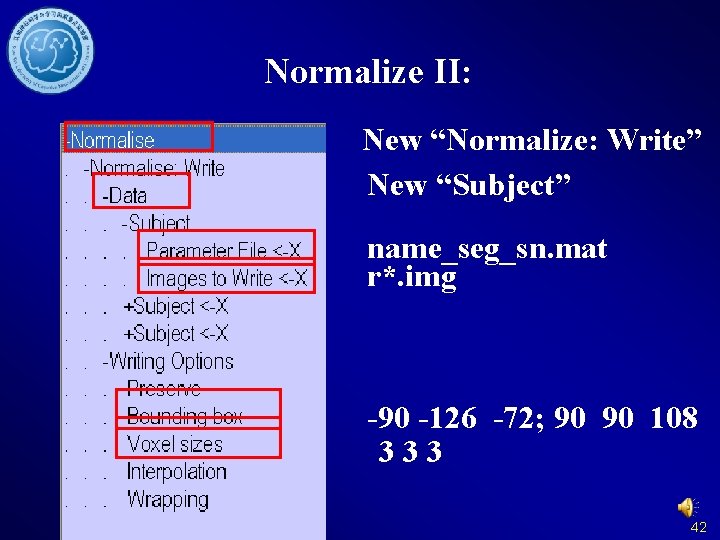 Normalize II: New “Normalize: Write” New “Subject” name_seg_sn. mat r*. img -90 -126 -72;