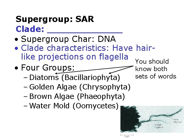 Supergroup: SAR Clade: _______ • Supergroup Char: DNA • Clade characteristics: Have hairlike projections