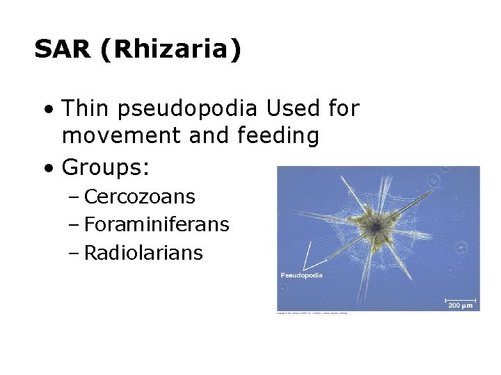 SAR (Rhizaria) • Thin pseudopodia Used for movement and feeding • Groups: – Cercozoans