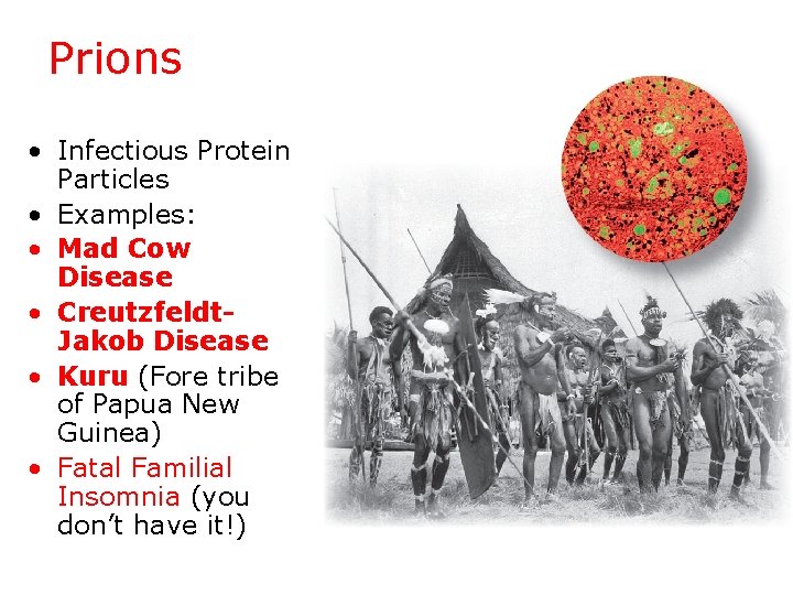 Prions • Infectious Protein Particles • Examples: • Mad Cow Disease • Creutzfeldt. Jakob