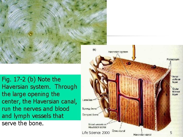 Fig. 17 -2 (b) Note the Haversian system. Through the large opening the center,