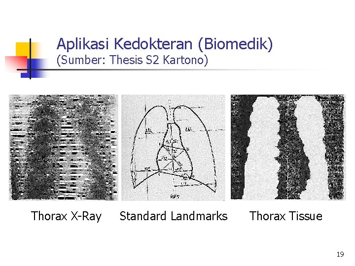 Aplikasi Kedokteran (Biomedik) (Sumber: Thesis S 2 Kartono) Thorax X-Ray Standard Landmarks Thorax Tissue
