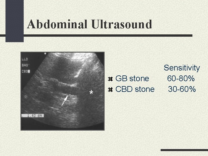 Abdominal Ultrasound GB stone CBD stone Sensitivity 60 -80% 30 -60% Abdominal Ultrasound GB stone CBD stone Sensitivity 60 -80% 30 -60%