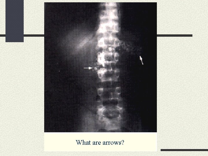 What are arrows? What are arrows?