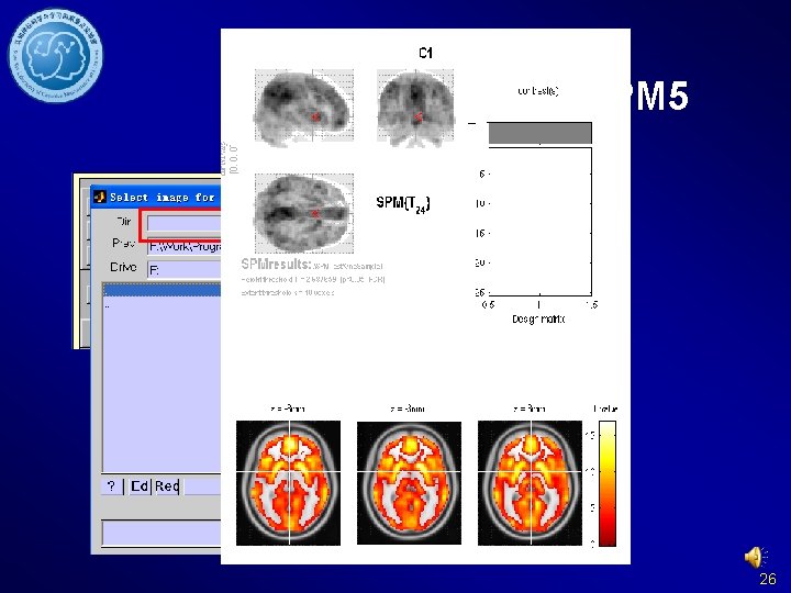 Results Viewing - SPM 5 26 