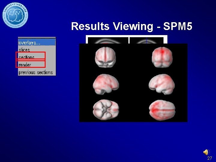 Results Viewing - SPM 5 27 