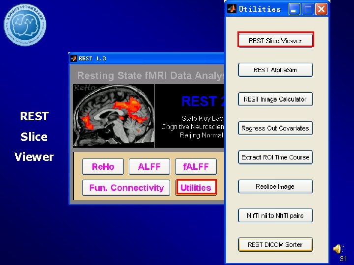 REST Slice Viewer 31 