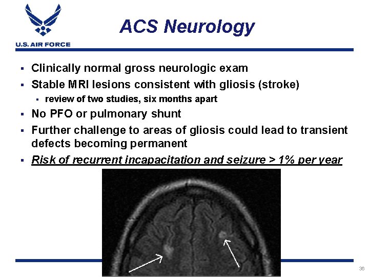 ACS Neurology Clinically normal gross neurologic exam § Stable MRI lesions consistent with gliosis
