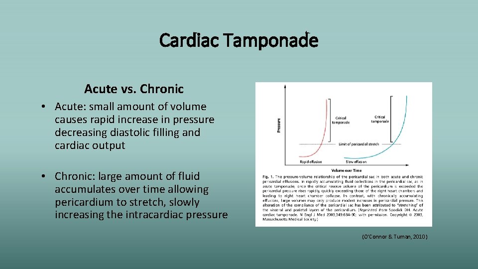 Cardiac Tamponade Acute vs. Chronic • Acute: small amount of volume causes rapid increase