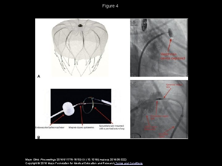 Figure 4 Mayo Clinic Proceedings 2016 911778 -1810 DOI: (10. 1016/j. mayocp. 2016. 08.