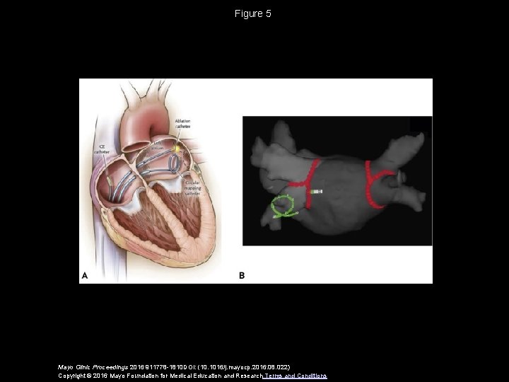 Figure 5 Mayo Clinic Proceedings 2016 911778 -1810 DOI: (10. 1016/j. mayocp. 2016. 08.