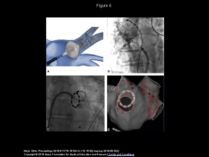 Figure 6 Mayo Clinic Proceedings 2016 911778 -1810 DOI: (10. 1016/j. mayocp. 2016. 08.