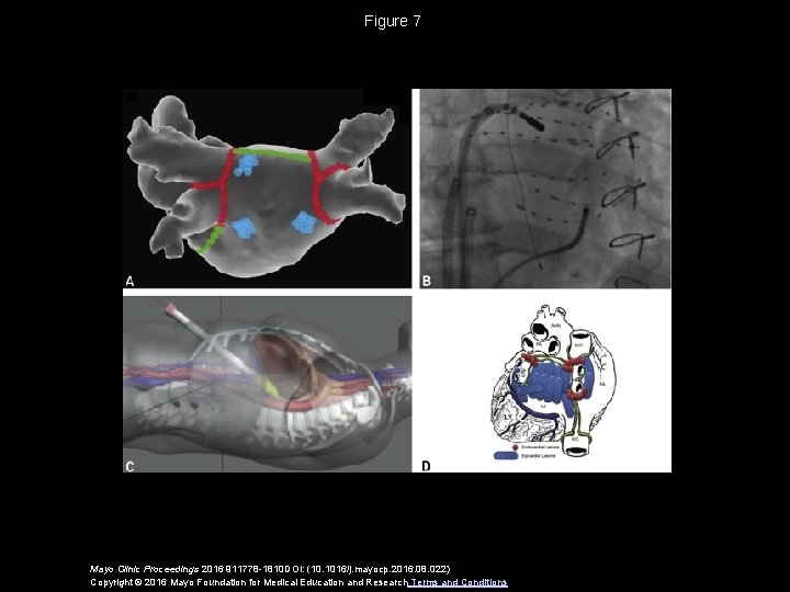 Figure 7 Mayo Clinic Proceedings 2016 911778 -1810 DOI: (10. 1016/j. mayocp. 2016. 08.