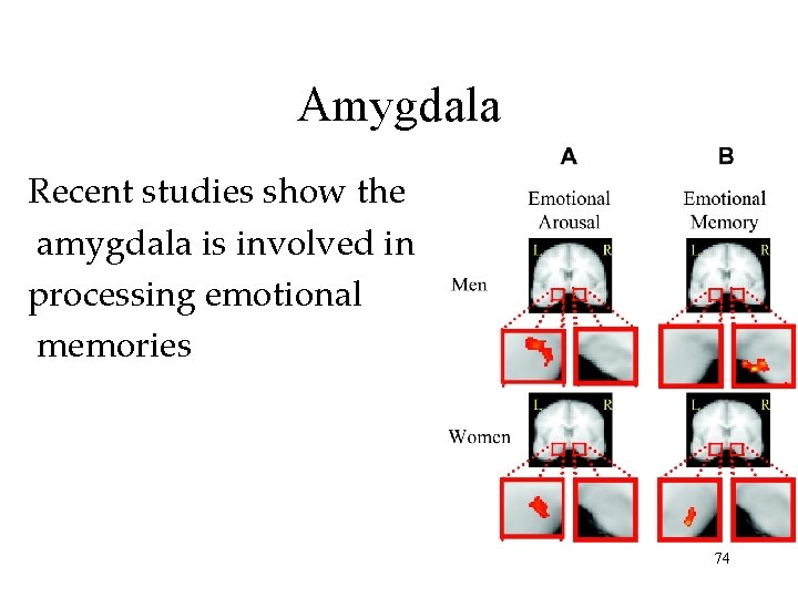 Amygdala Recent studies show the amygdala is involved in processing emotional memories 74 Amygdala Recent studies show the amygdala is involved in processing emotional memories 74