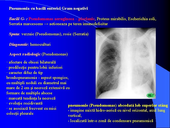 Pneumonia cu bacili enterici Gram negativi Bacili G- : Pseudomonas aeruginosa – piocianic, Proteus