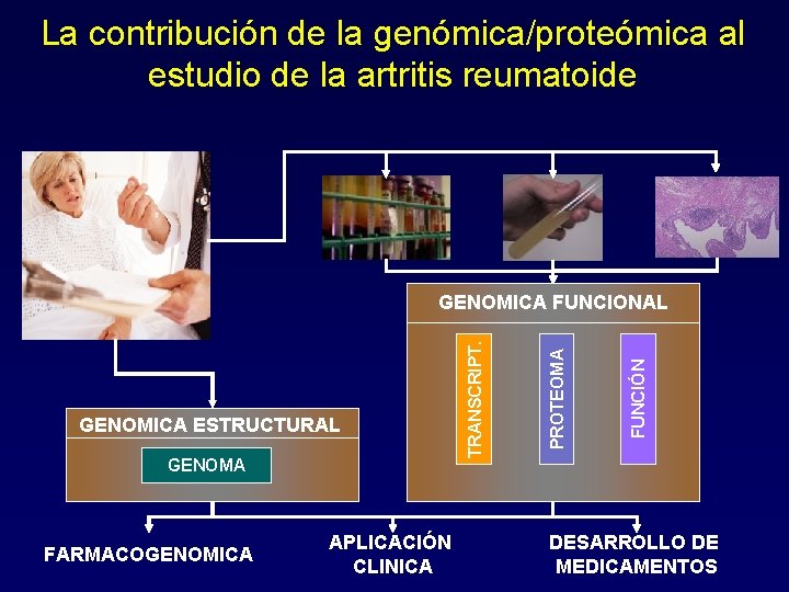 La contribución de la genómica/proteómica al estudio de la artritis reumatoide GENOMA FARMACOGENOMICA APLICACIÓN