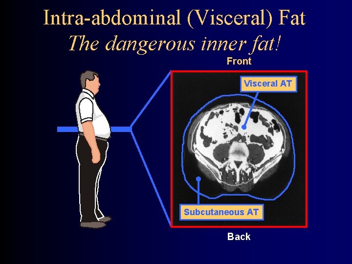 Intra-abdominal (Visceral) Fat The dangerous inner fat! Front Visceral AT Subcutaneous AT Back 