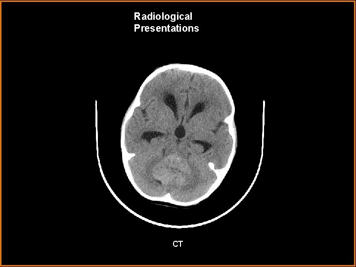 Radiological Presentations CT 