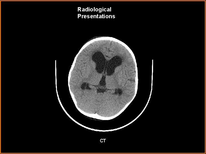 Radiological Presentations CT 