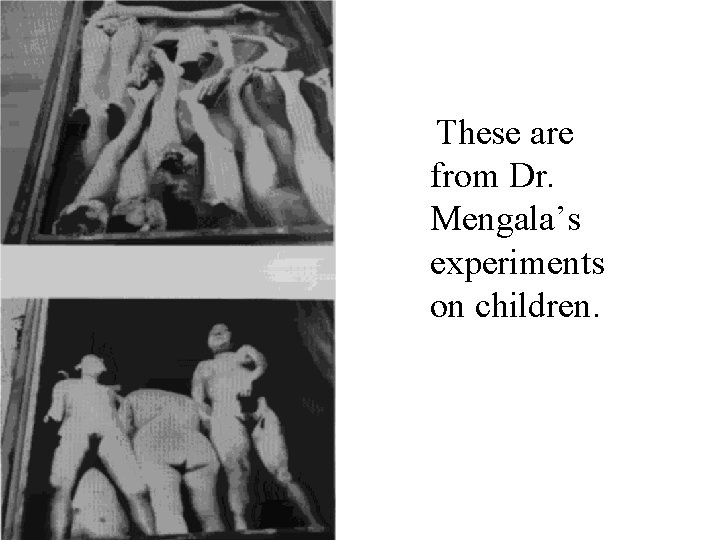These are from Dr. Mengala’s experiments on children. 