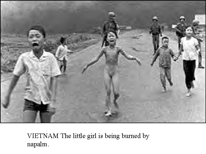 VIETNAM The little girl is being burned by napalm. 