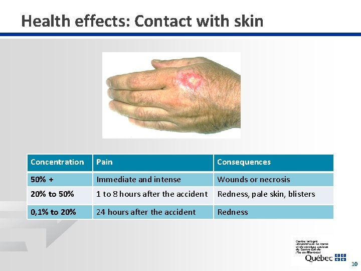 Health effects: Contact with skin Concentration Pain Consequences 50% + Immediate and intense Wounds