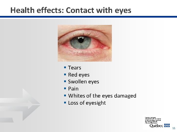 Health effects: Contact with eyes § Tears § Red eyes § Swollen eyes §