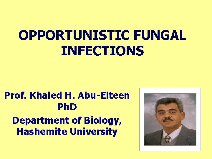 OPPORTUNISTIC FUNGAL INFECTIONS Prof. Khaled H. Abu-Elteen Ph. D Department of Biology, Hashemite University