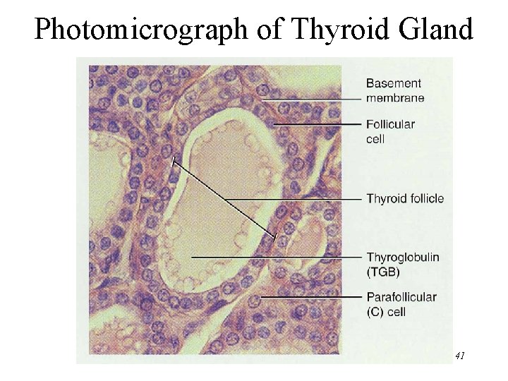 Photomicrograph of Thyroid Gland 41 