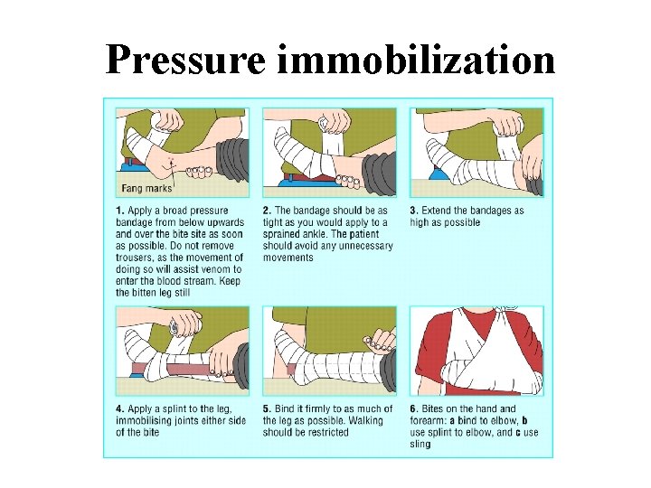 Pressure immobilization 