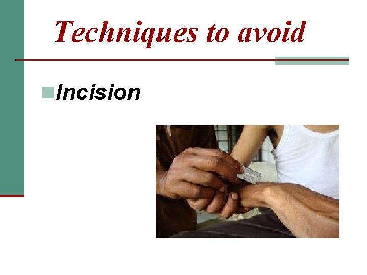Techniques to avoid n. Incision 