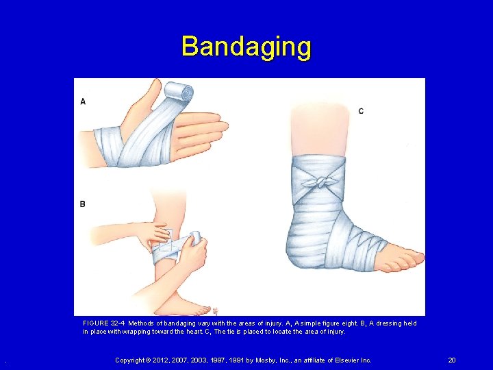 Bandaging FIGURE 32 -4 Methods of bandaging vary with the areas of injury. A, A Bandaging FIGURE 32 -4 Methods of bandaging vary with the areas of injury. A, A