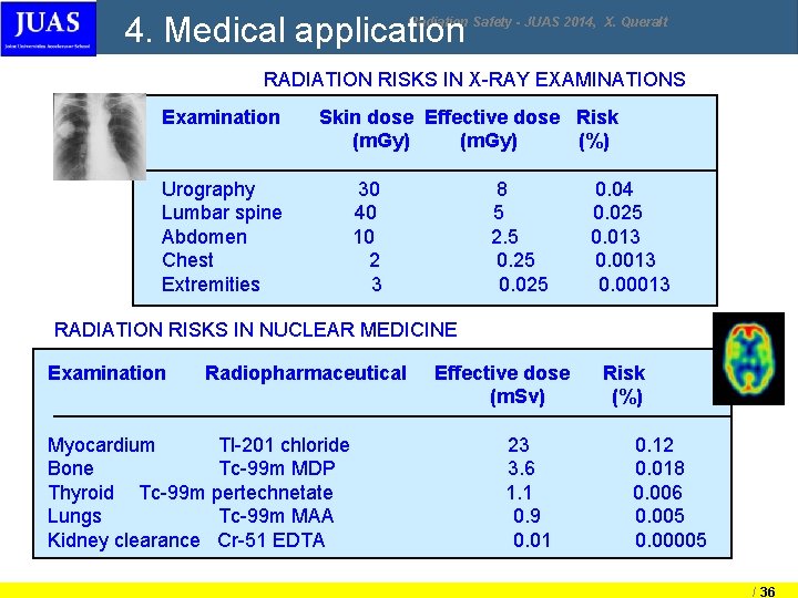 4. Medical application Radiation Safety - JUAS 2014, X. Queralt RADIATION RISKS IN X-RAY 4. Medical application Radiation Safety - JUAS 2014, X. Queralt RADIATION RISKS IN X-RAY