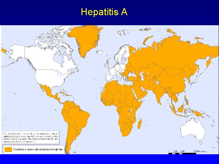 Hepatitis A 