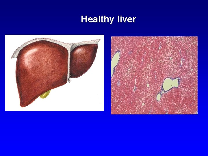 Healthy liver 