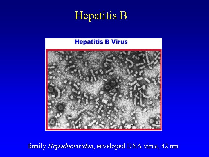  Hepatitis B family Hepadnaviridae, enveloped DNA virus, 42 nm 