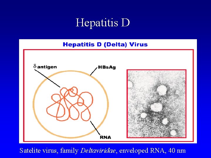 Hepatitis D Satelite virus, family Deltaviridae, enveloped RNA, 40 nm 
