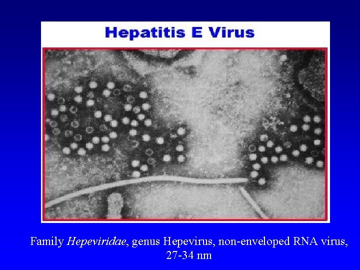 Family Hepeviridae, genus Hepevirus, non-enveloped RNA virus, 27 -34 nm 