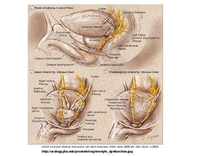 http: //urology. jhu. edu/prostate/img/erectyle_dysfunction. jpg 